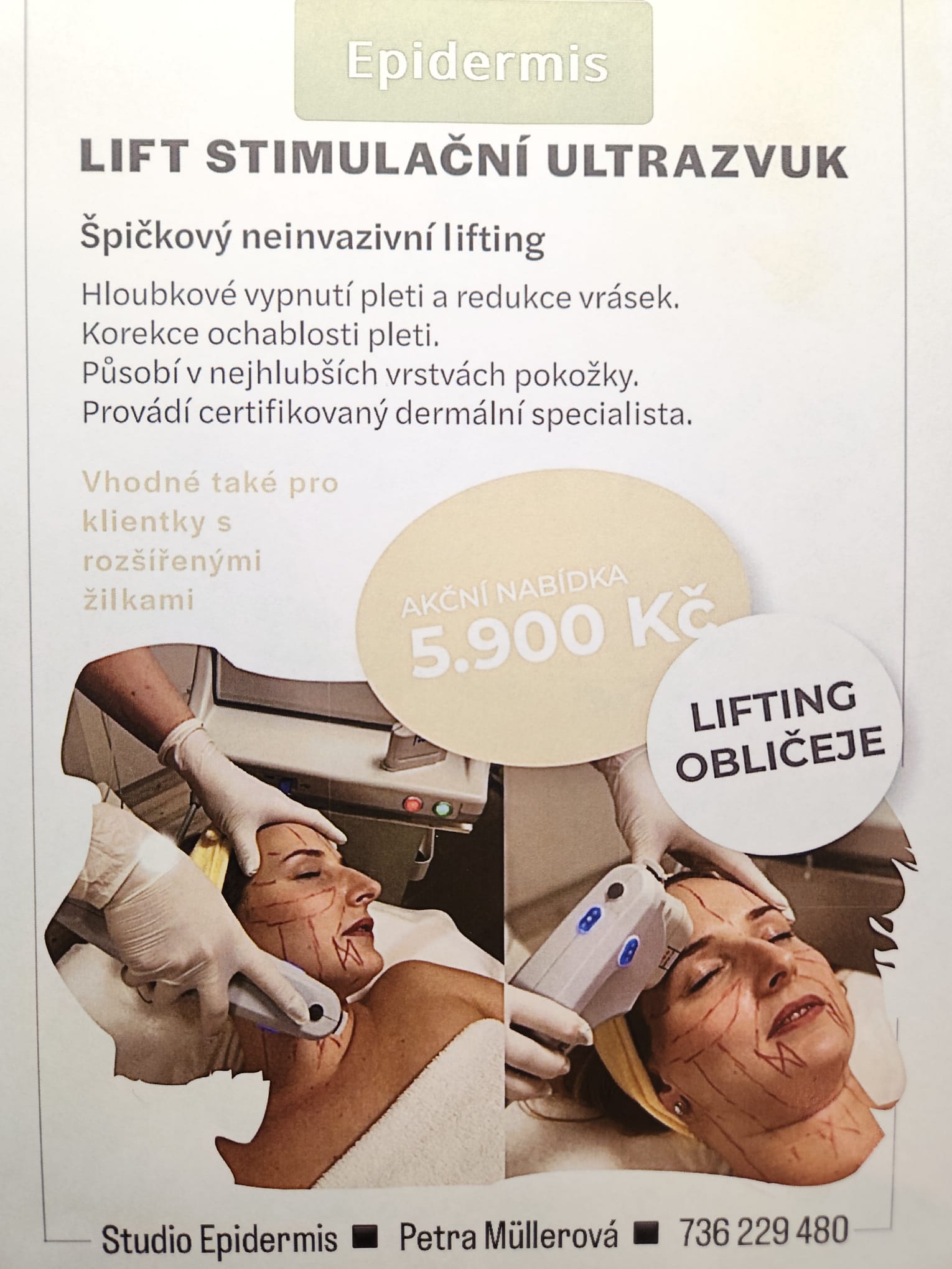 Lift Stimulační Ultrazvuk