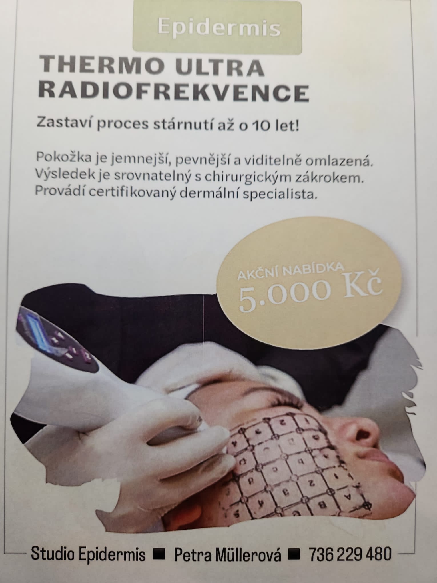 thermo ultra radiofrekvence